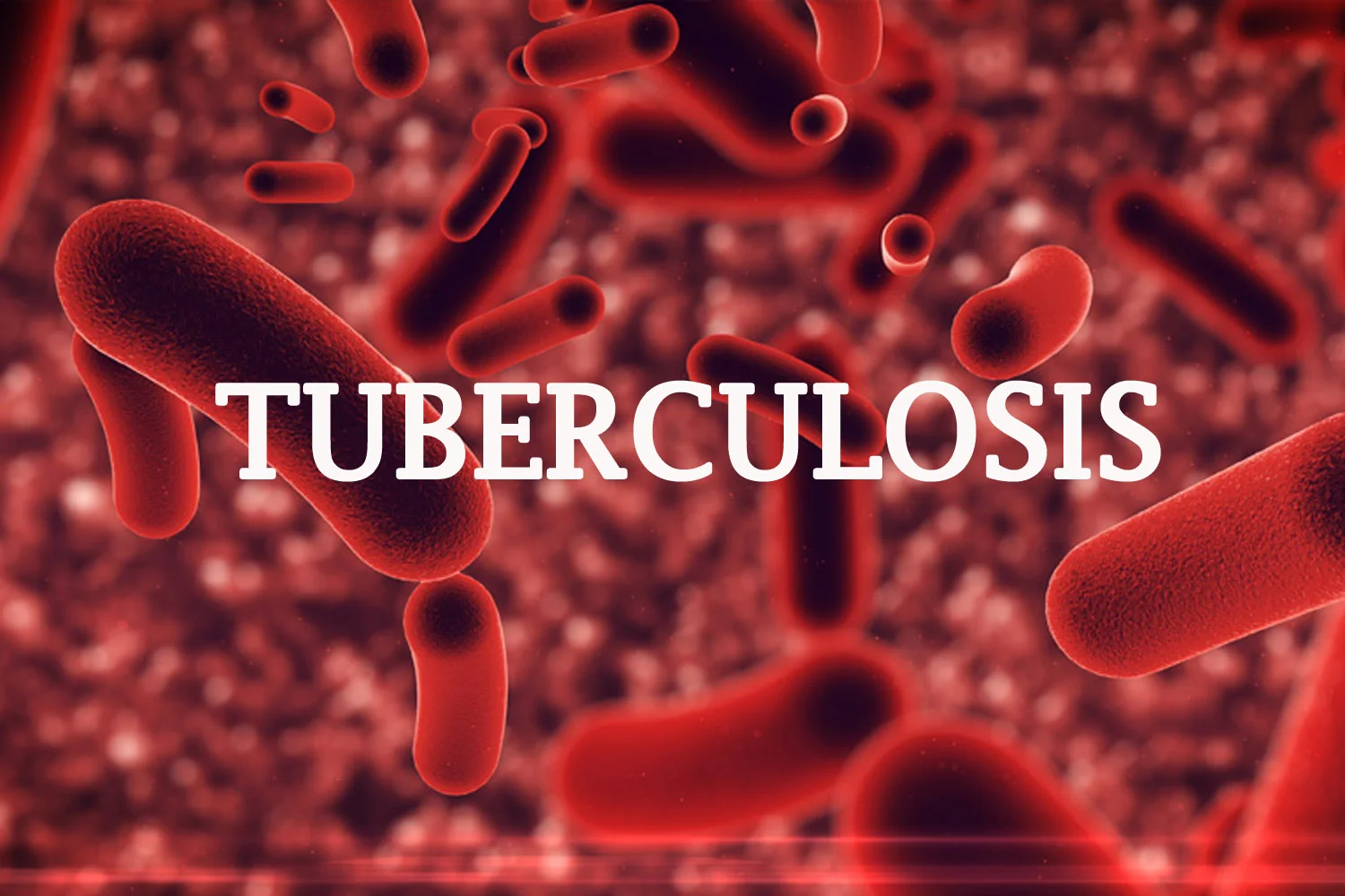 Tuberculosis-1