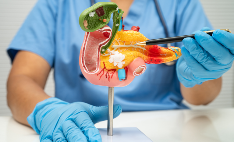 Pancreatic Cancer Treatment Breakthrough Extends Survival